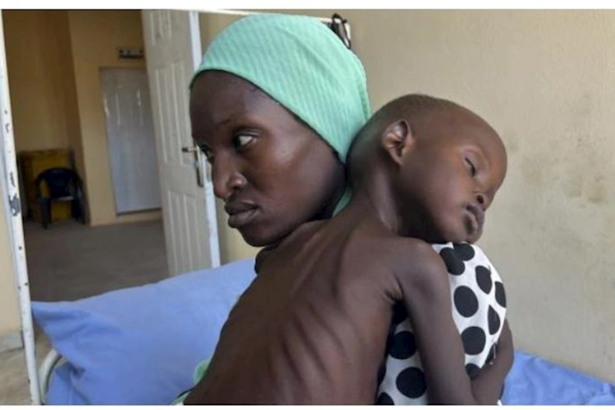 Nigeriyada difteriya epidemiyasından ölənlərin sayı 600-ü ötdü