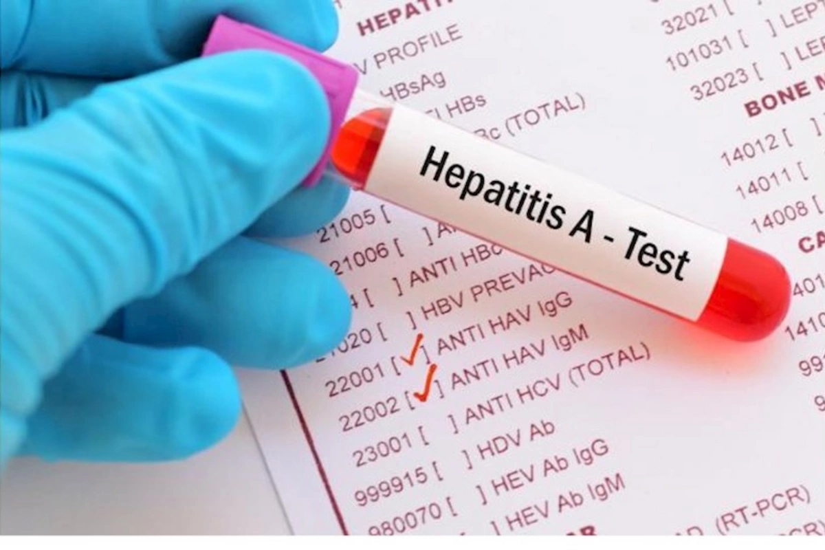 Məktəblərdə “Hepatit A” virusu yayılır: Valideynlər nəyə diqqət etməlidir? (VİDEO)
