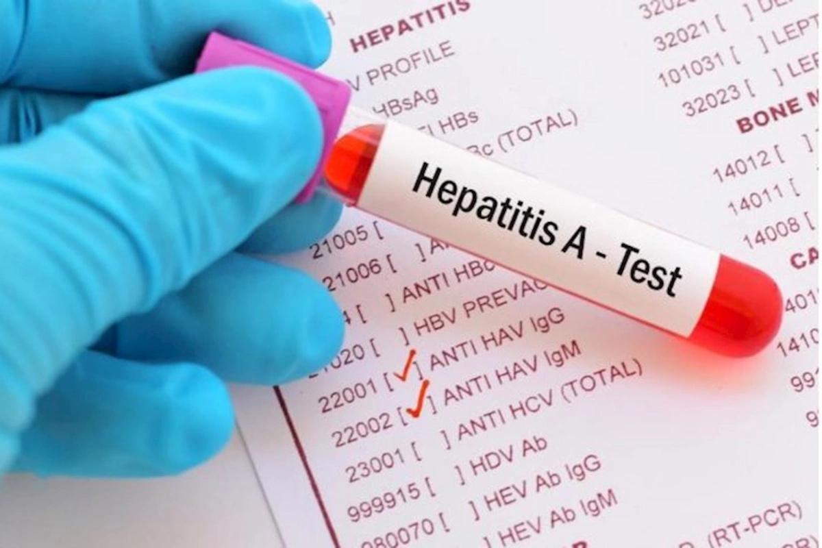 Hepatit A virusundan uşaqları necə qoruyaq? — Həkimdən AÇIQLAMA