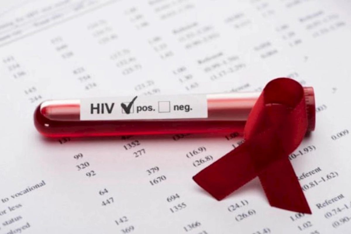 ÜST Avropada ən sürətlə artan İİV epidemiyasını elan etdi