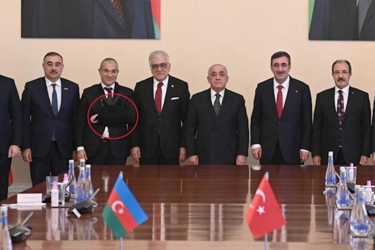 Mikayıl Cabbarov qolunu niyə sarğılayıb? — FOTO