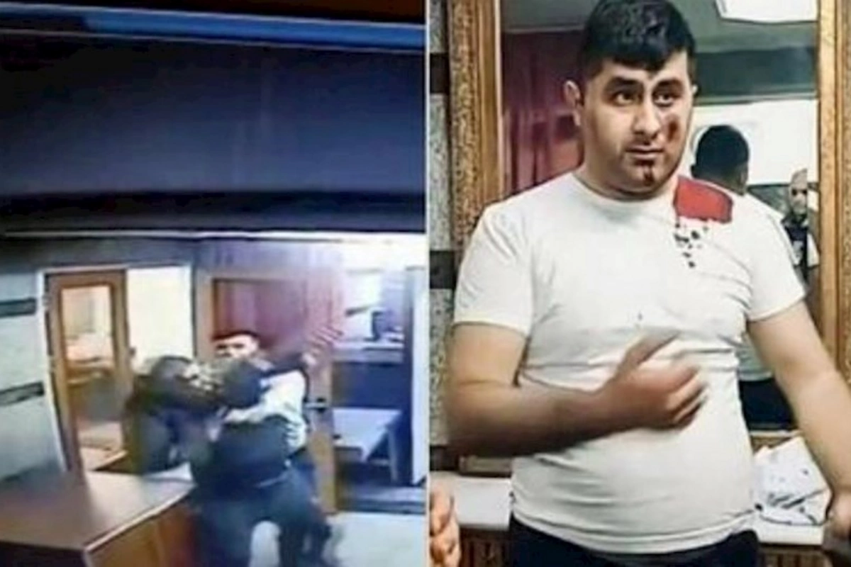 Terrorçu Vasif Tağıyevi tapança ilə yaralayıbmış — Özü danışdı