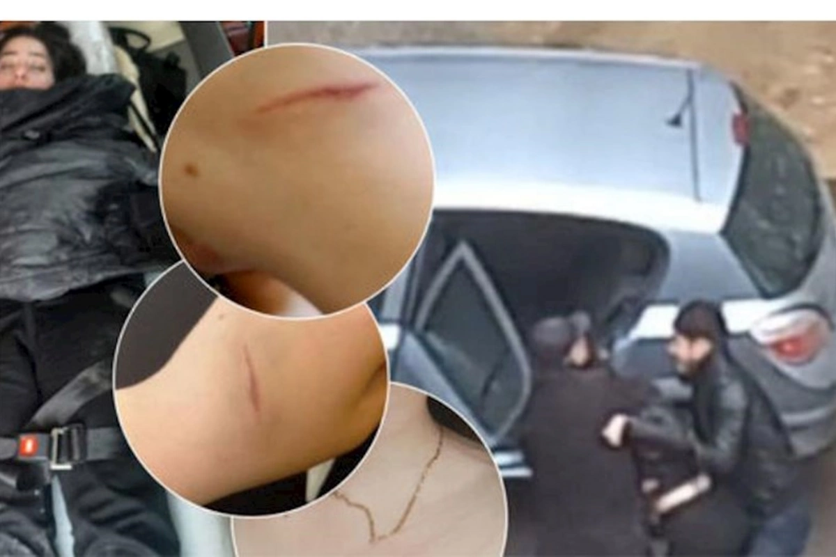 Ana maşına zorla mindirilərək qaçırılan qızından xəbər ala bilmir: “Getmədiyim polis idarəsi yoxdur” — VİDEO