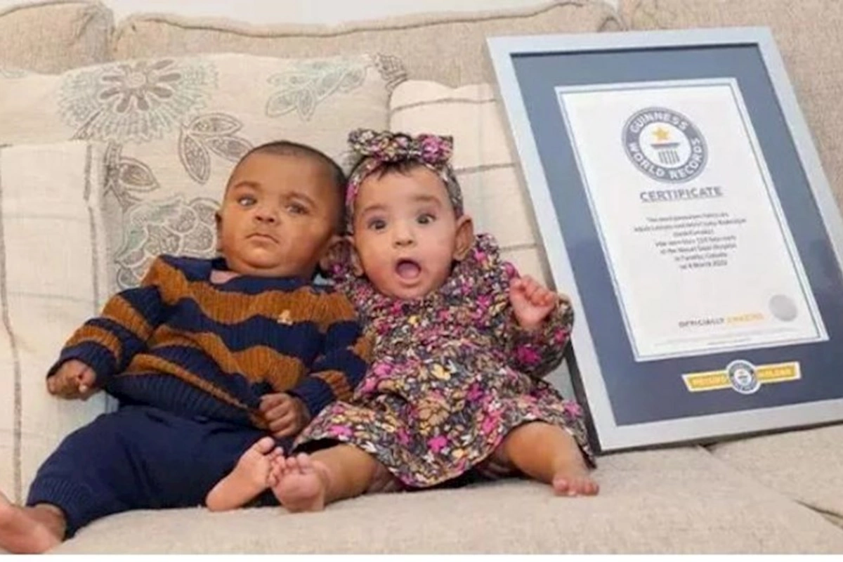 Dünyanın ən erkən doğulan əkizləri Ginnesin Rekordlar Kitabına düşdü — FOTO