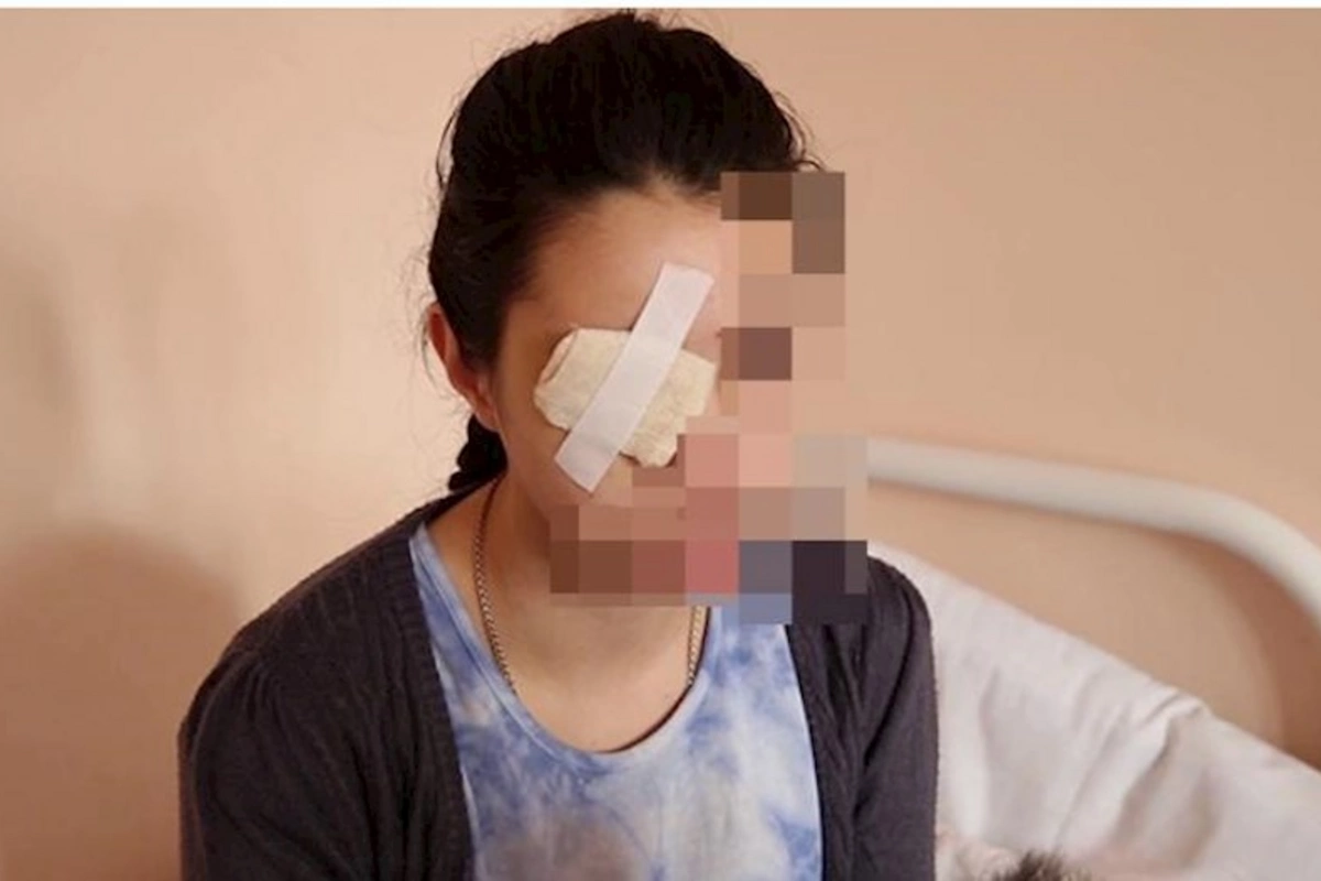 Evə taksi ilə gəldiyi üçün döyülən qadın: “Uşaqlar gözümü necə çıxardığını gördülər”