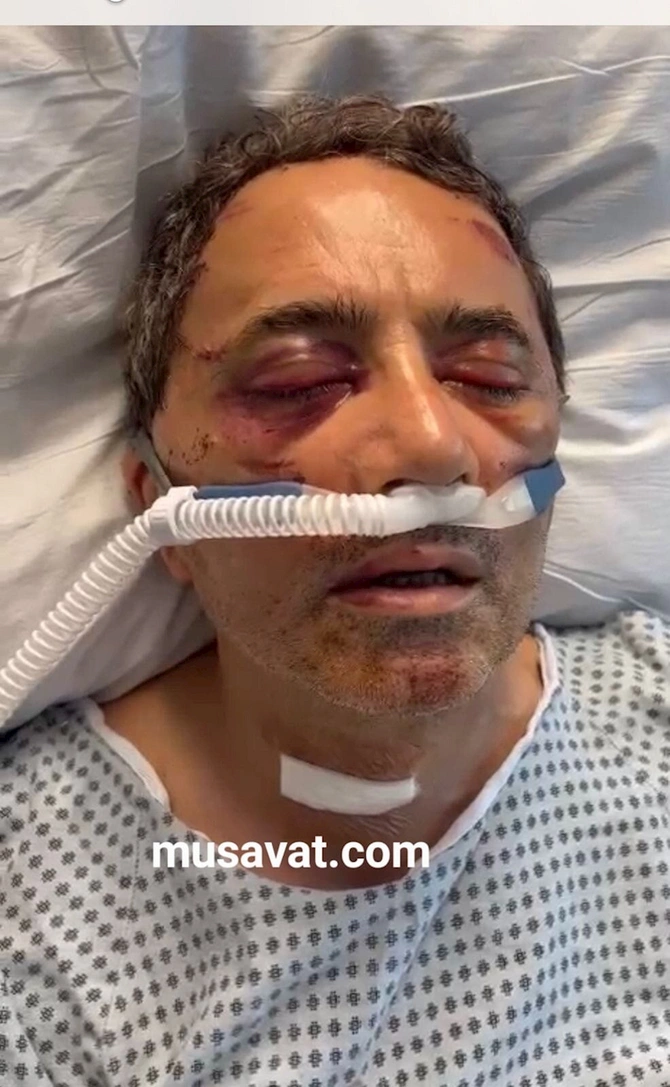 Əhməd Obalını və oğlu Dənizi ABŞ-da ölümcül döydülər — FOTO
