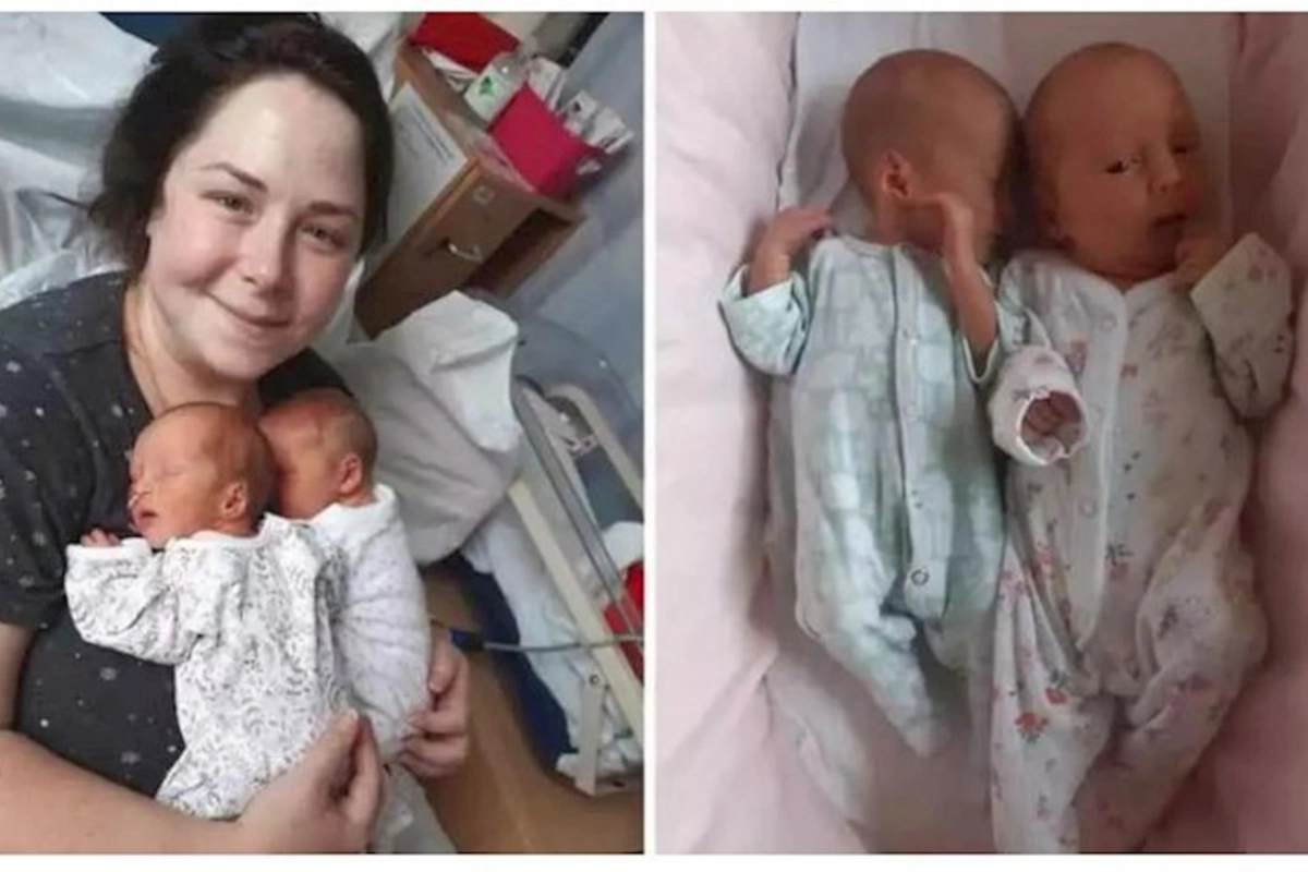 Eyni anda doğulan uşaqlar əkiz deyil — FOTO