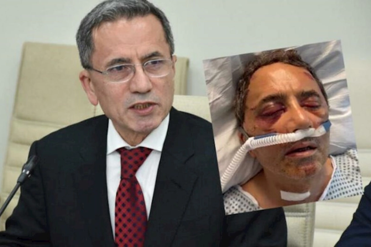 Əhməd Obalını oğlu döyüb — SENSASİYA