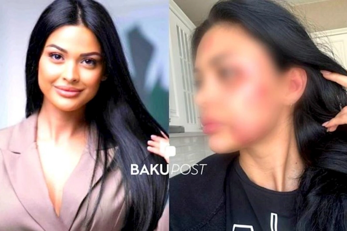 Tanınmış aparıcı DÖYÜLDÜ — DİN araşdırma başlatdı