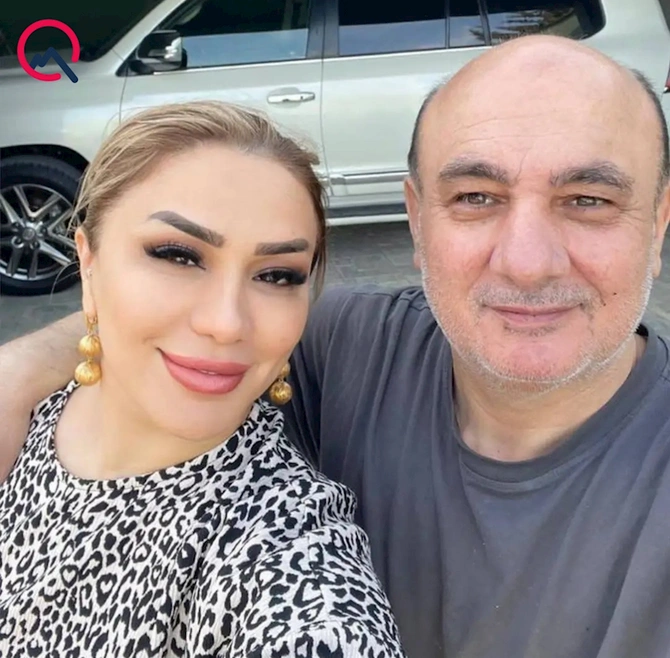 Tanınmış plastik-cərrah Bakıda bağ evində öldürüldü — FOTO