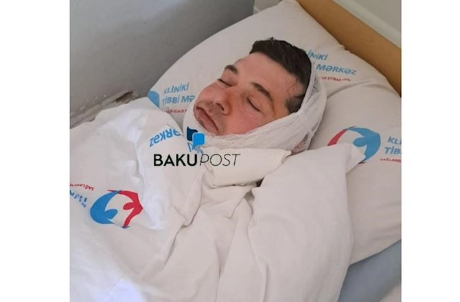 Çənəsi sındırılan qazi əməliyyat olundu — Xəstəxanadan FOTOLARI Çənəsi sındırılan qazi əməliyyat olundu — Xəstəxanadan FOTOLARI
