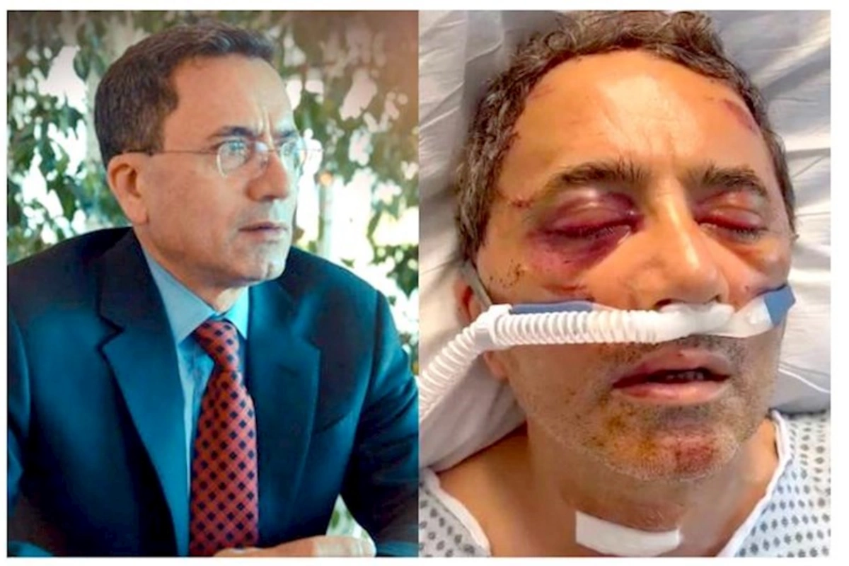 Əhməd Obalı sağalır, tezliklə qalxıb hər şeyə aydınlıq gətirəcək — Araz Obalı