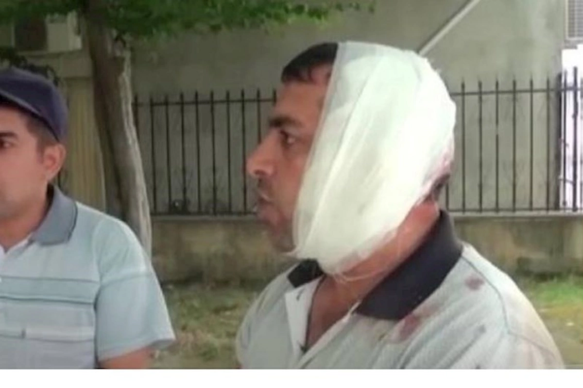 “Bir də gördüm, qulağım yoxdur…” — Eşşək kişinin qulağını qopartdı (VİDEO)