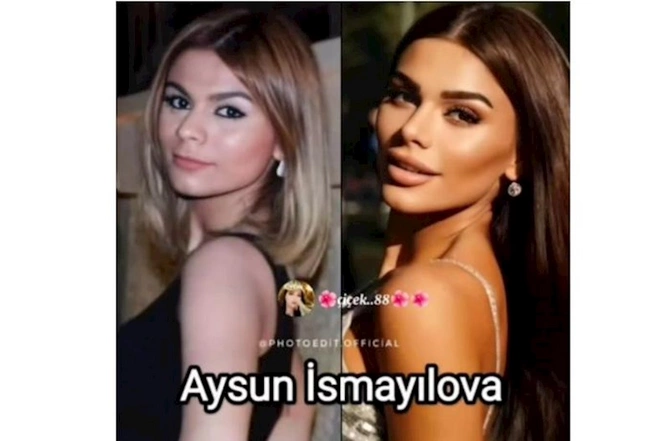 Məşhurlarımızın əməliyyatdan əvvəl və sonrakı HALLARI — FOTOLAR Məşhurlarımızın əməliyyatdan əvvəl və sonrakı HALLARI — FOTOLAR