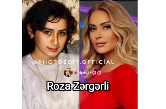 Məşhurlarımızın əməliyyatdan əvvəl və sonrakı HALLARI — FOTOLAR Məşhurlarımızın əməliyyatdan əvvəl və sonrakı HALLARI — FOTOLAR