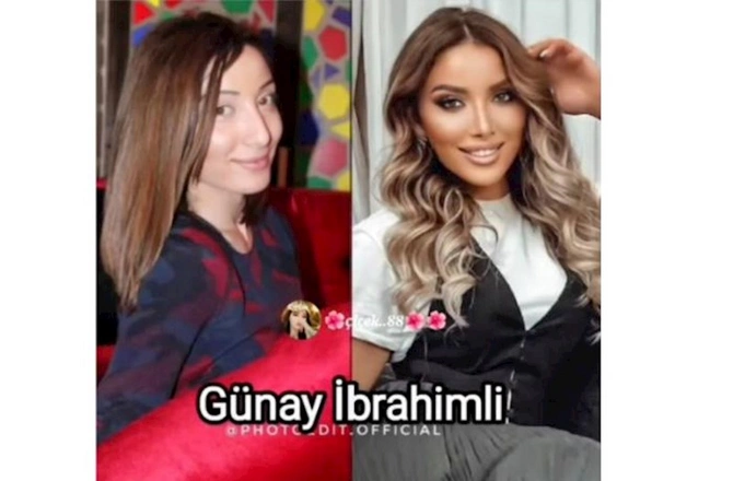 Məşhurlarımızın əməliyyatdan əvvəl və sonrakı HALLARI — FOTOLAR Məşhurlarımızın əməliyyatdan əvvəl və sonrakı HALLARI — FOTOLAR