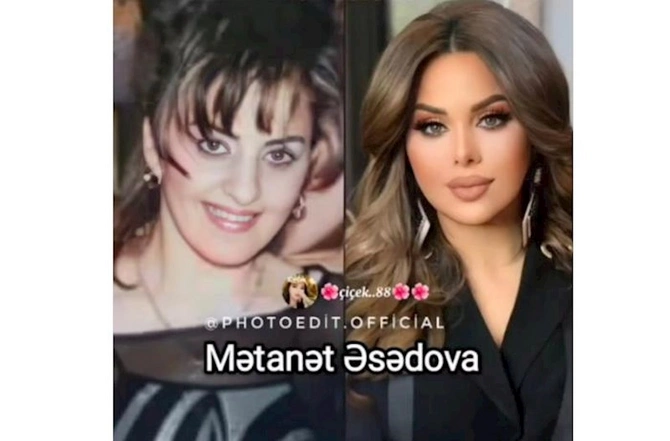 Məşhurlarımızın əməliyyatdan əvvəl və sonrakı HALLARI — FOTOLAR Məşhurlarımızın əməliyyatdan əvvəl və sonrakı HALLARI — FOTOLAR