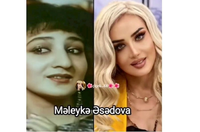 Məşhurlarımızın əməliyyatdan əvvəl və sonrakı HALLARI — FOTOLAR Məşhurlarımızın əməliyyatdan əvvəl və sonrakı HALLARI — FOTOLAR