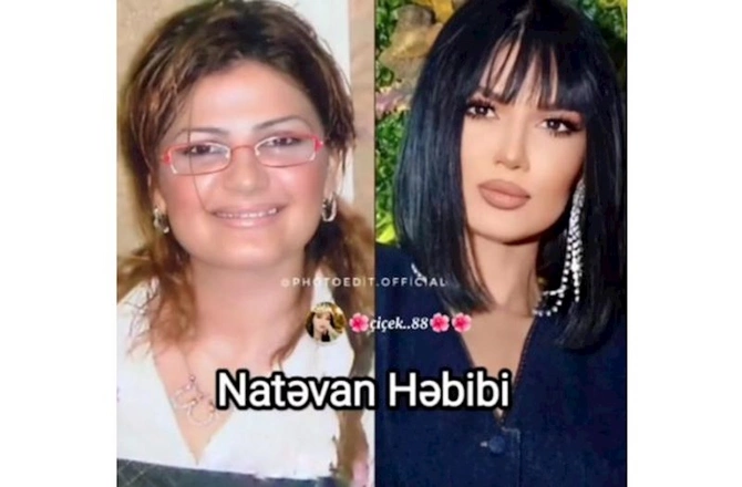 Məşhurlarımızın əməliyyatdan əvvəl və sonrakı HALLARI — FOTOLAR Məşhurlarımızın əməliyyatdan əvvəl və sonrakı HALLARI — FOTOLAR