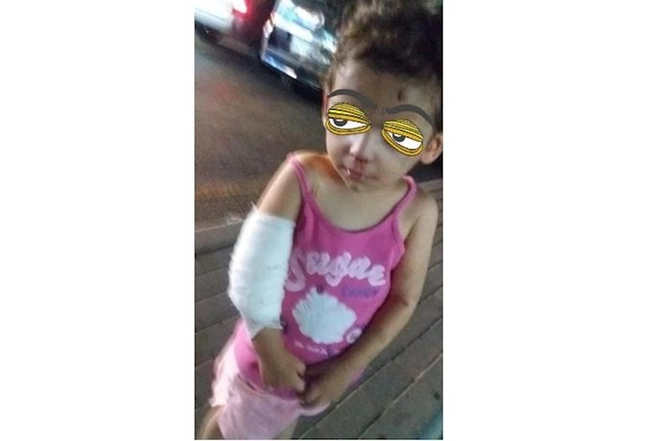Sumqayıtda nənə nəvəsini vəhşicəsinə döydü — FOTO Sumqayıtda nənə nəvəsini vəhşicəsinə döydü — FOTO