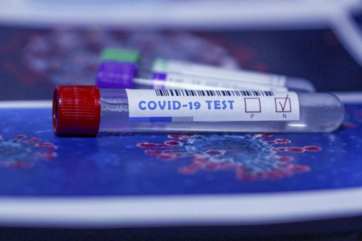 SN: Sərt karantin tədbirlərinə ehtiyac yoxdur, epidemioloji vəziyyət stabildir
