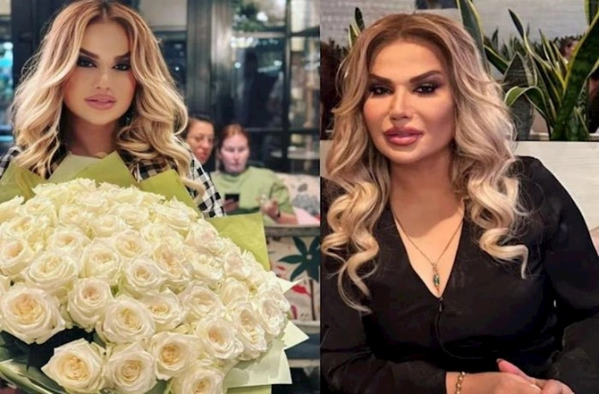 Nazənin tanınmaz halda — FOTO