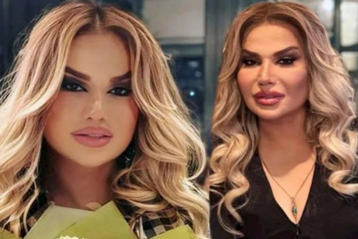 Nazənin tanınmaz halda — FOTO