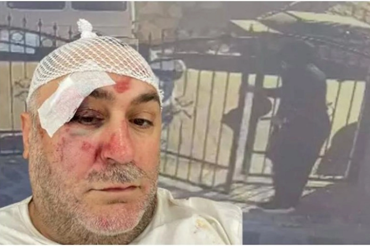 Ofisiant müdirini döyüb 100 minini apardı — VİDEO