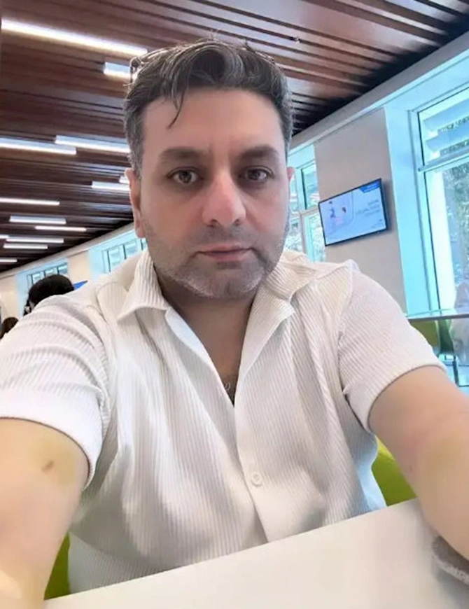Əməliyyat olunan Elcanın son halı — FOTO