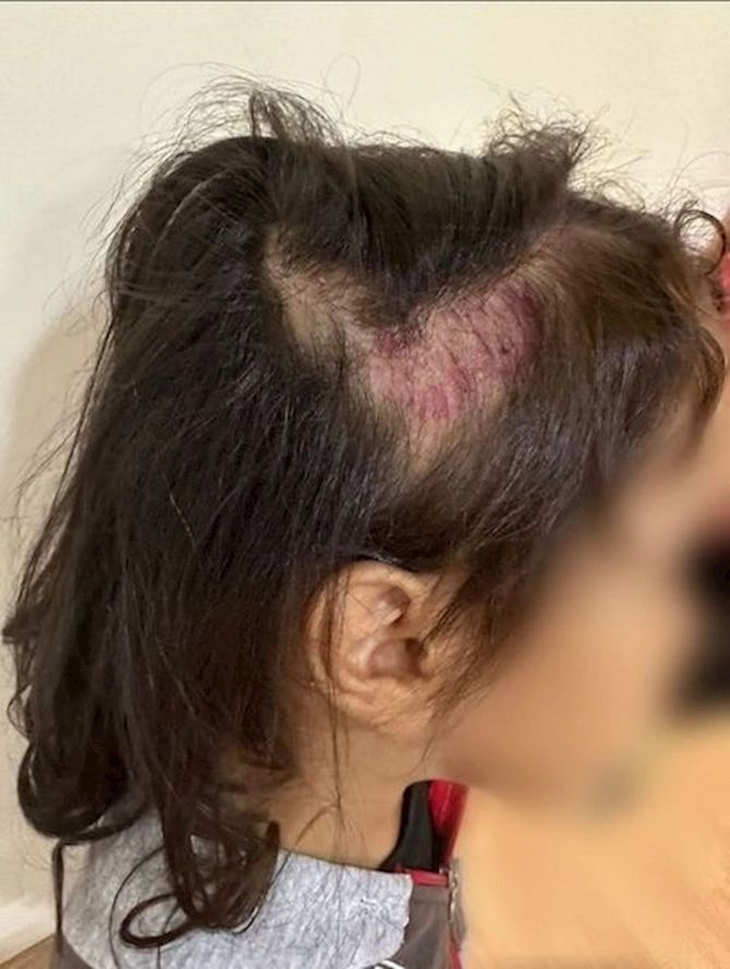 Bakıda dəhşət: Bacılara valideynləri tərəfindən işgəncə verilib — FOTOLAR Bakıda dəhşət: Bacılara valideynləri tərəfindən işgəncə verilib — FOTOLAR