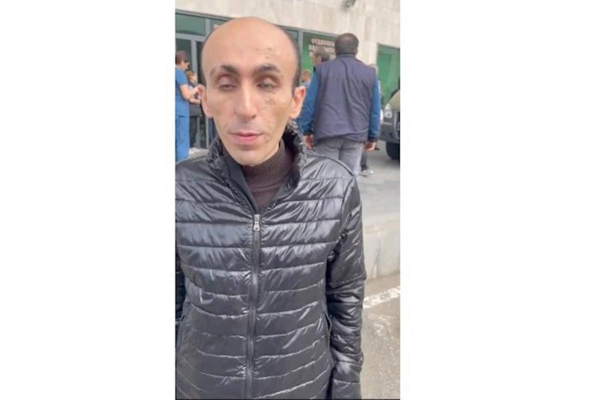Artak Beglaryan qondarma rejimin rəhbərliyini təslim olmağa ÇAĞIRDI