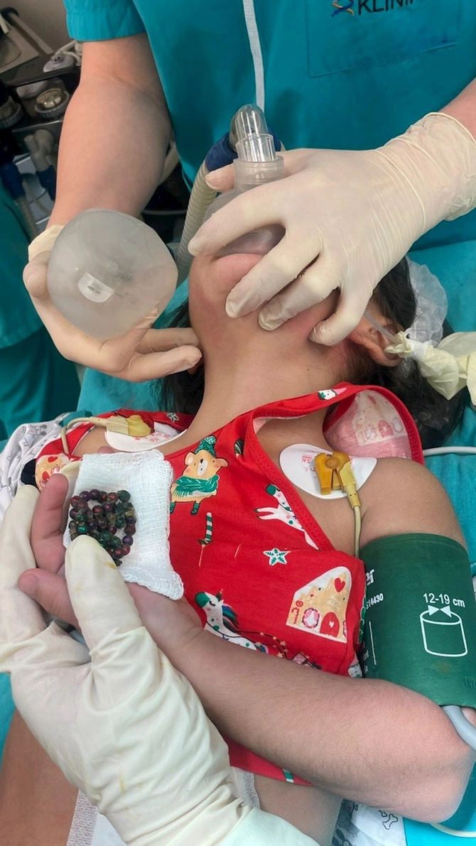 Bakıda 4 yaşlı uşaq 53 maqnit udub — FOTOLAR