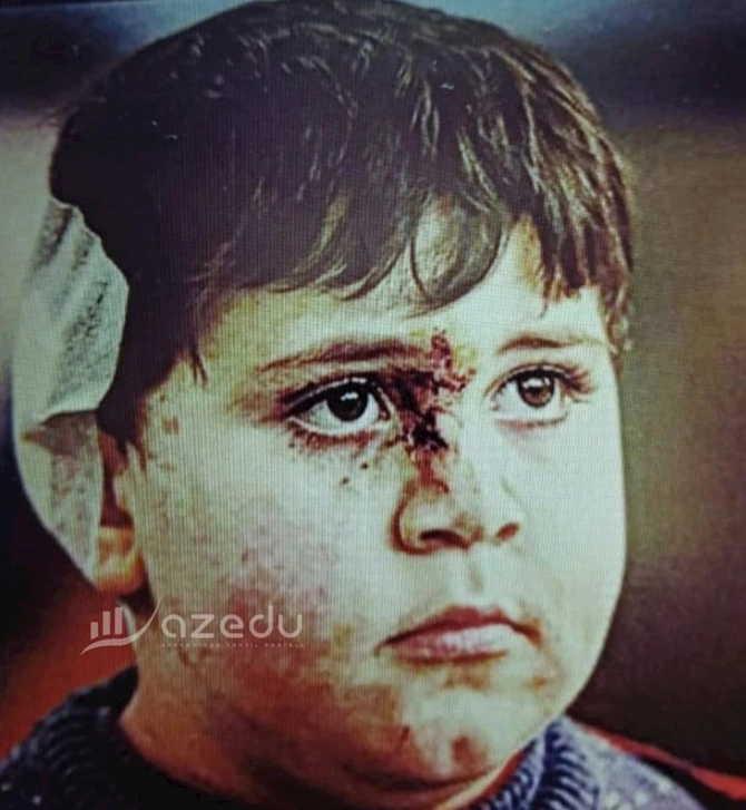 Gəncə terrorunun balaca qurbanı: Polad Həşimov kimi olmaq istəyirəm (FOTOLAR)