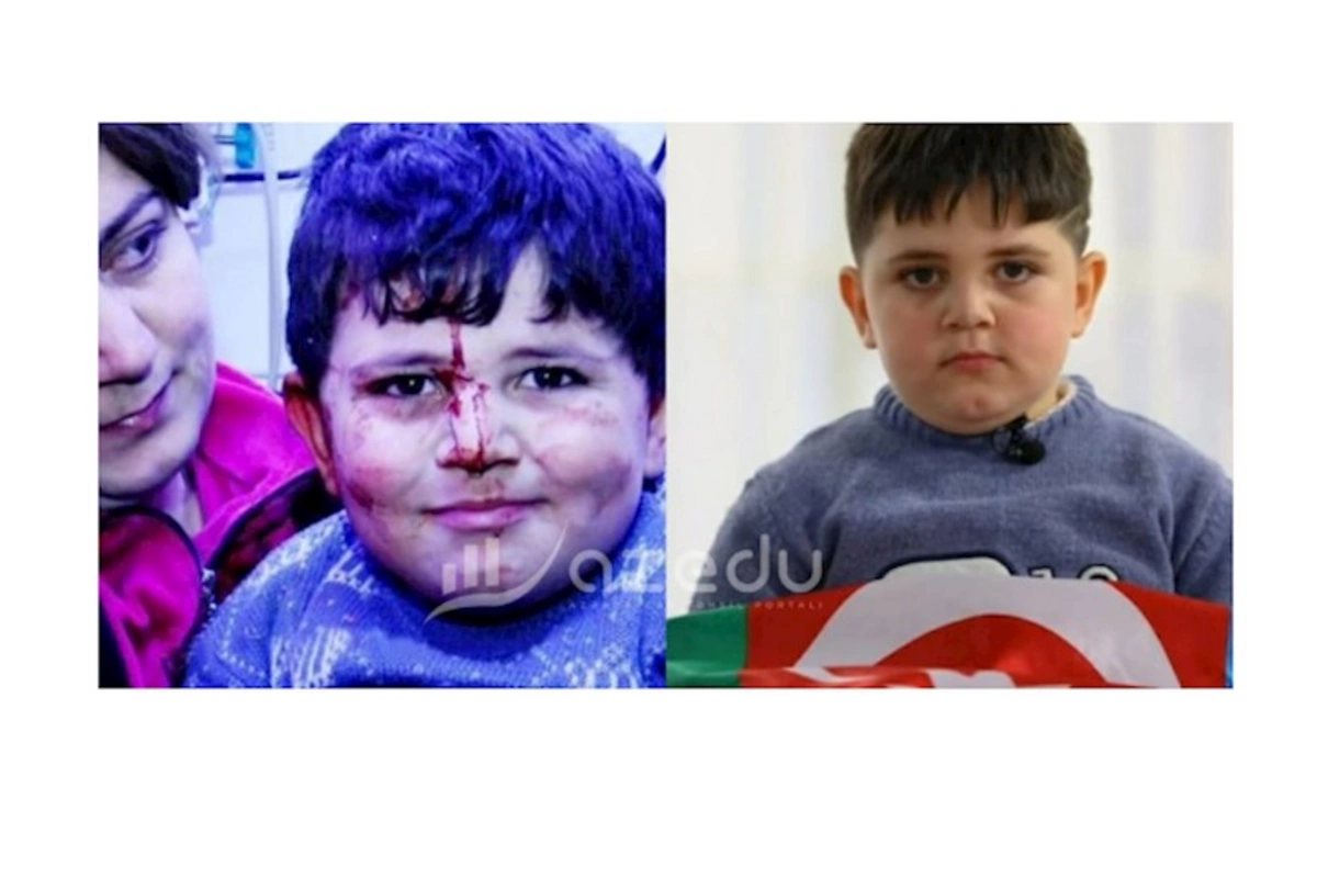 Gəncə terrorunun balaca qurbanı: Polad Həşimov kimi olmaq istəyirəm (FOTOLAR)