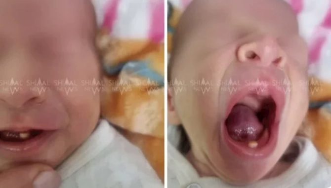 Qubada qeyri-adi görünüşlü körpə doğuldu — FOTO