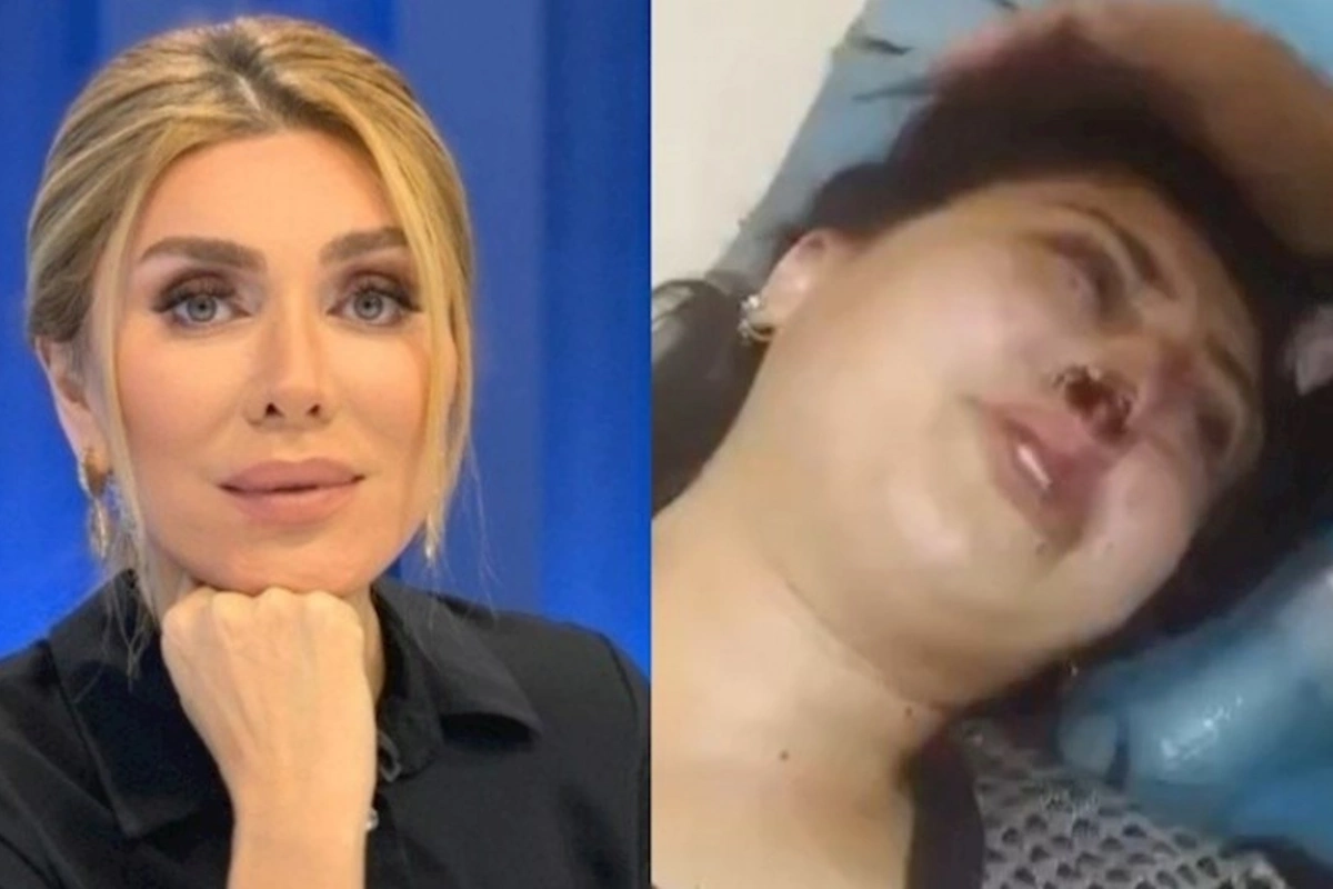 Xoşqədəm əri və baldızı tərəfindən döyülən qadının görüntülərini paylaşdı — VİDEO