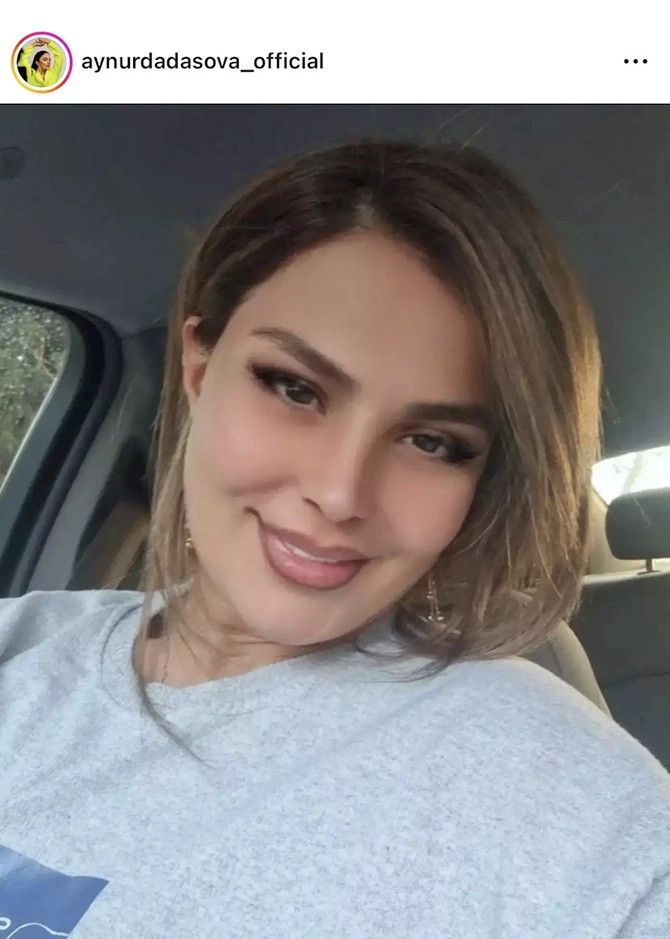 Aynur Dadaşova tanınmaz halda — FOTO Aynur Dadaşova tanınmaz halda — FOTO