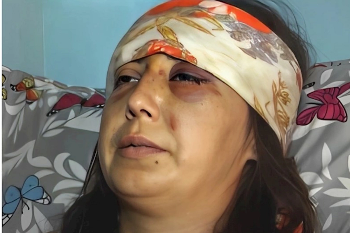 Bətnindəki körpənin cinsiyyəti qız olduğuna görə hamilə qadını döyərək uşağı tələf etdilər — VİDEO