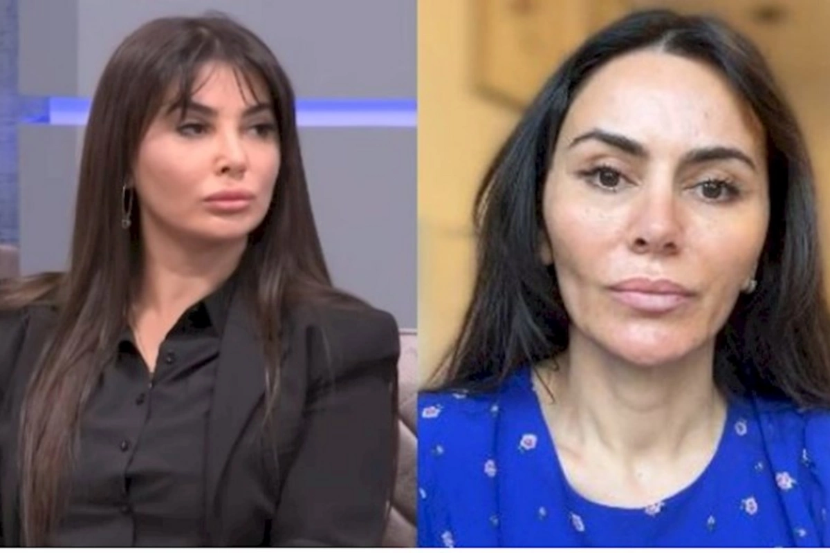 Lazeroloqluqdan həkimliyə — Ülviyyə İlyasova kimdir?