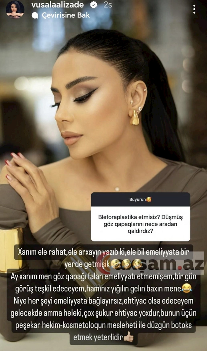 Vüsalədən estetik iddialarına cavab