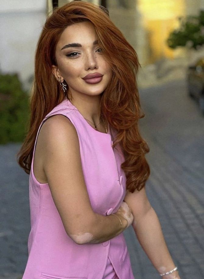 Tanınmış bloger bu gün əməliyyat olunacaq — FOTOLAR