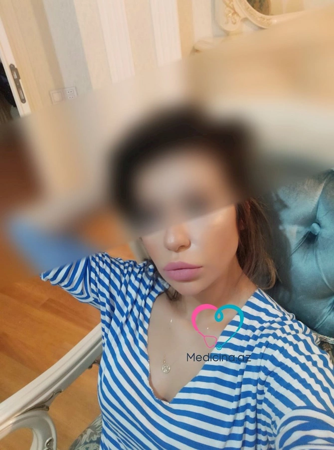Daha bir estetik əməliyyat faciəsi — Baş həkim həmkarının burnunu tanınmaz hala saldı (FOTOLAR)
