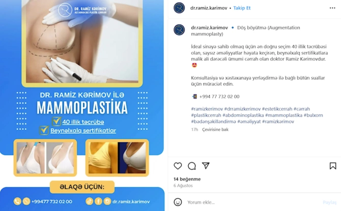 Həkimin əməliyyatından sonra xəstə şikayət etdi — Reo Med cərimələndi