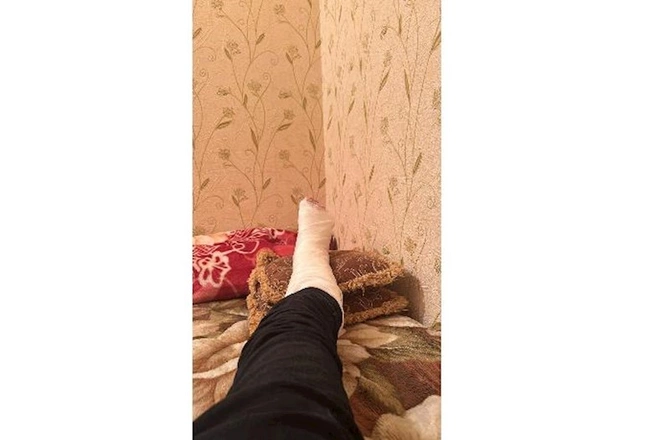 “Azəriqaz”ın əməkdaşına xəsarət yetirildi — FOTO