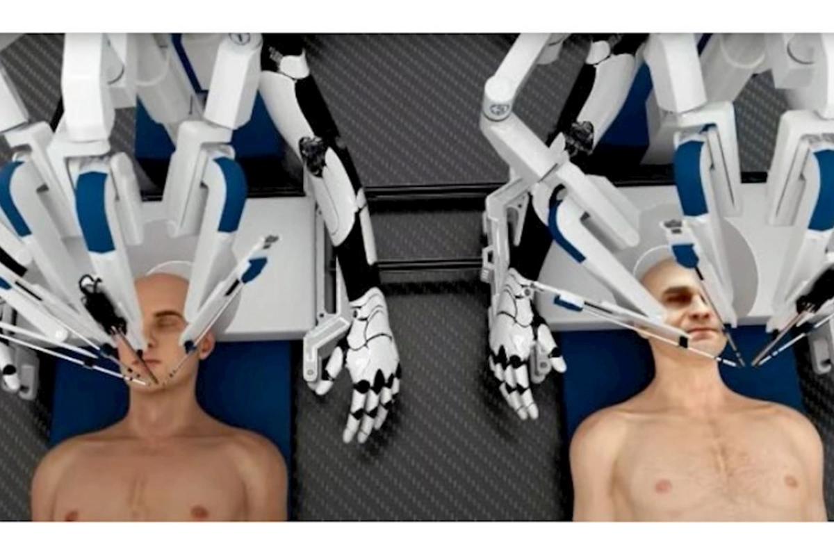 Robotlar baş transplantasiyasını həyata keçirə bilər