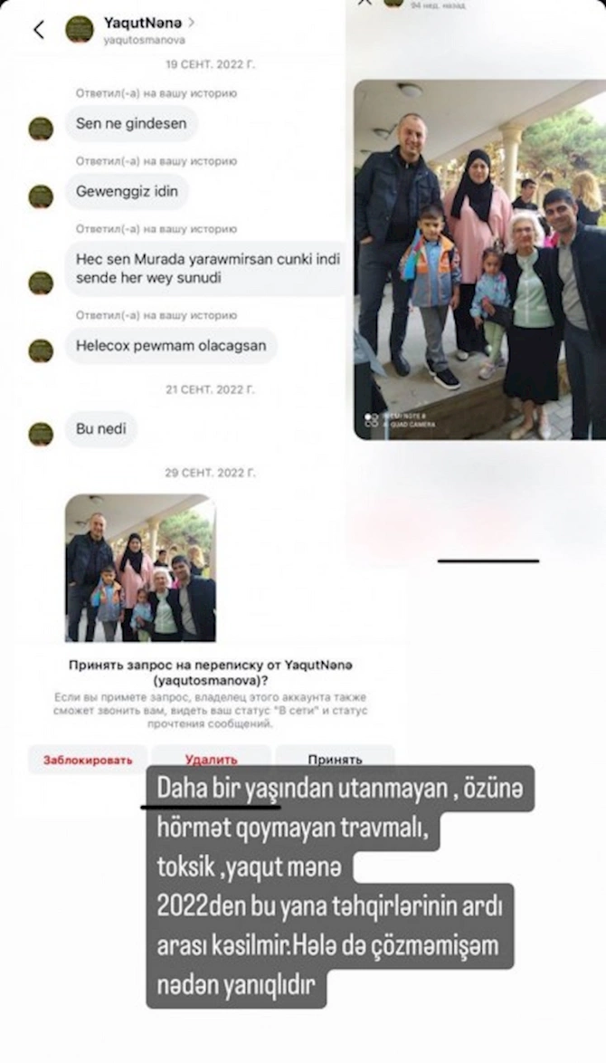 “Anlamıram ki, nədən yanıqlıdır” — FOTO