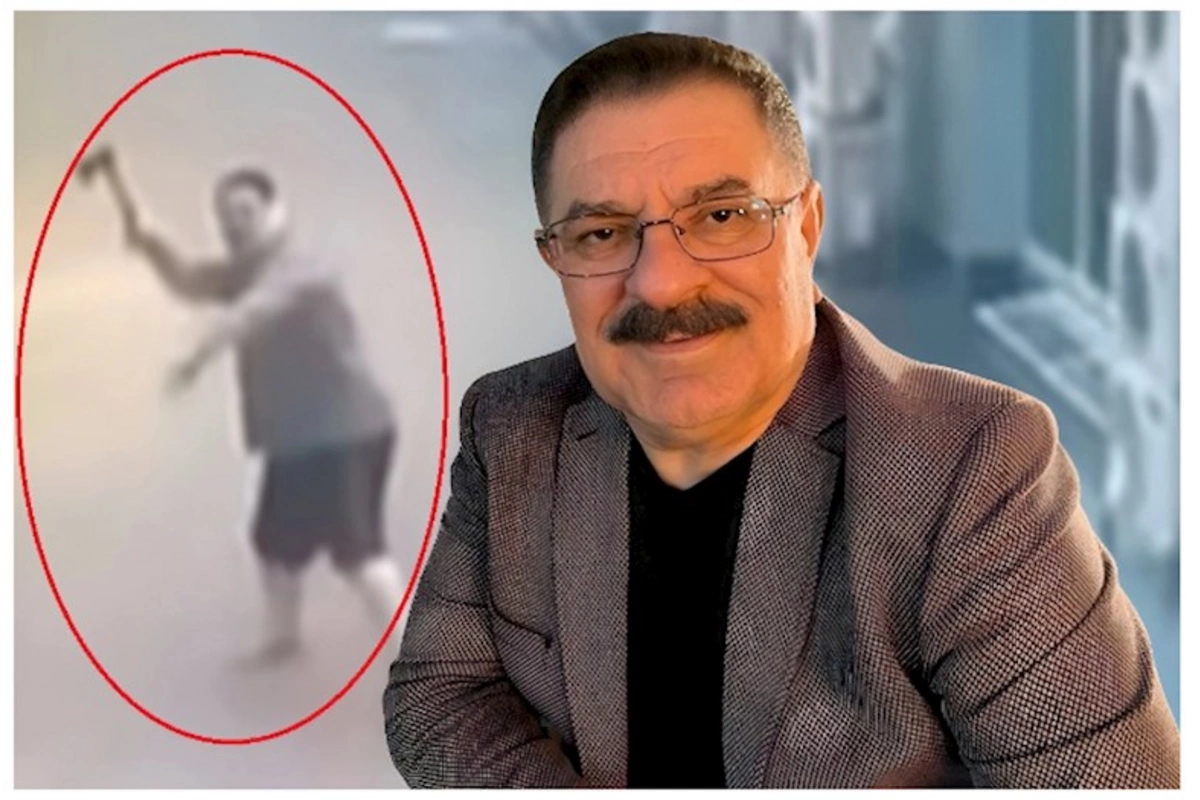 Ağadadaş Ağayevin qulağına nə olub?