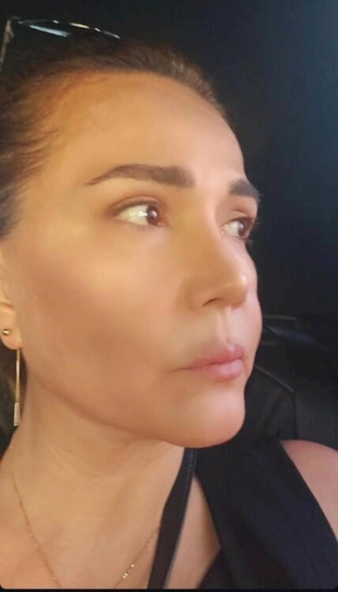 Xalq artistinin makiyajsız halı diqqət çəkdi — FOTO