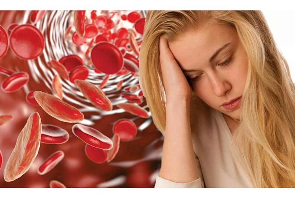 Anemiyanın simptomları və müalicəsi necədir?