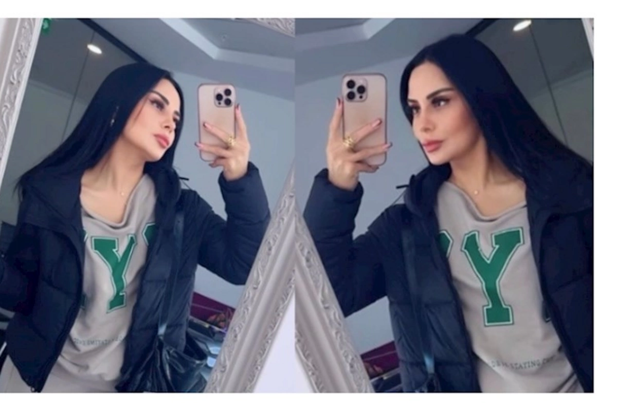 Vüsalənin üzündəki dəyişiklik müzakirə yaratdı